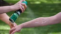 10 mejores remedios después de una picadura de mosquito