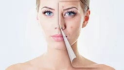 10 mejores cremas para pieles con problemas