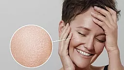 20 bästa krämerna för fet hy