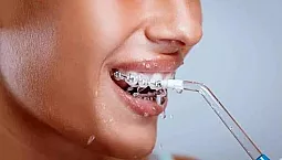 20 geriausių drėkintuvų