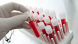 10 parimat analüüsilaborit Moskvas