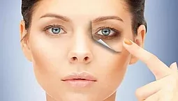 15 beste rettsmidler mot blåmerker under øynene