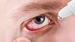 15 mejores gotas para la conjuntivitis