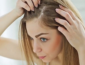 10 best iherb dandruff shampoos