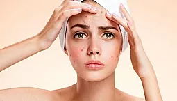 10 bästa vitaminerna för akne