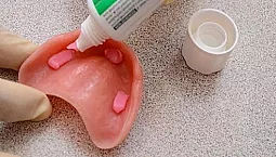 أفضل 10 كريمات أسنان