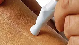 15 ubat terbaik untuk parut dan parut