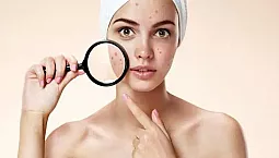 Los 10 mejores remedios para reducir los poros