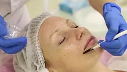 10 הפילינגים המקצועיים הטובים ביותר לפנים