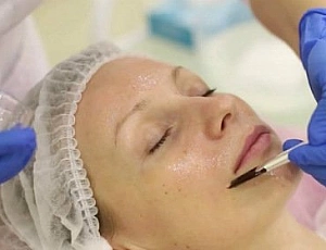 10 nejlepších profesionálních peelingů na obličej