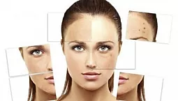 10 beste foundations for problematisk hud