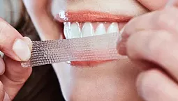 10 הפסים הטובים ביותר להלבנת שיניים