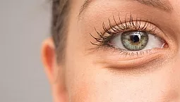Top 10 des remèdes contre les yeux gonflés