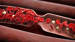 十大血液稀释剂