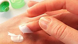 20 bästa krämerna och salvorna för allergier