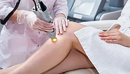 Top 5 professionelle hårfjerningsmaskiner