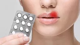 أكثر 10 أقراص فعالية لعلاج الهربس