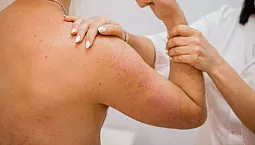 10 najboljših klinik za zdravljenje psoriaze v Moskvi