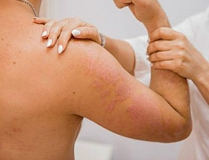 Top 10 klinik pro léčbu psoriázy v Moskvě