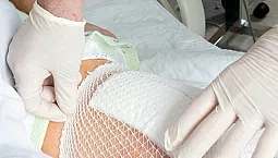 10 melhores pomadas para escaras para pacientes acamados