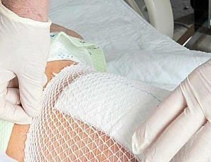 10 legjobb kenőcs felfekvés ellen fekvőbetegeknek