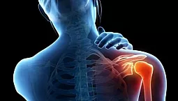 15 salap terbaik untuk sendi