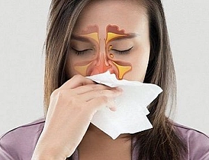 20 legjobb gyógymód sinusitis ellen