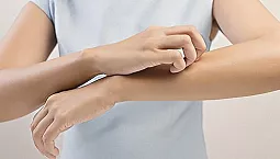 5 ubat terbaik untuk kudis