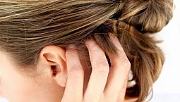 10 cele mai bune șampoane pentru psoriazis pe cap