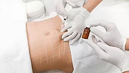 10 meilleurs lipolytiques