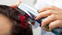 أفضل 5 أمشاط ليزر لتساقط الشعر