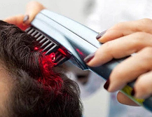 5 Best Laser Combs for Hair Loss