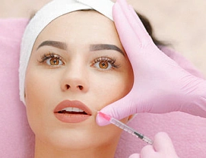 5 best fillers for nasolabial folds