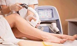 5 bästa laserhårborttagningskliniker i Jekaterinburg