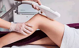 5 καλύτερες κλινικές αποτρίχωσης με λέιζερ στο Νίζνι Νόβγκοροντ